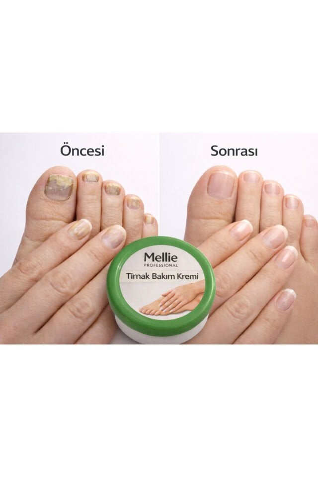 Tırnak Bakım Kremi Mantar Karşıtı 100ml